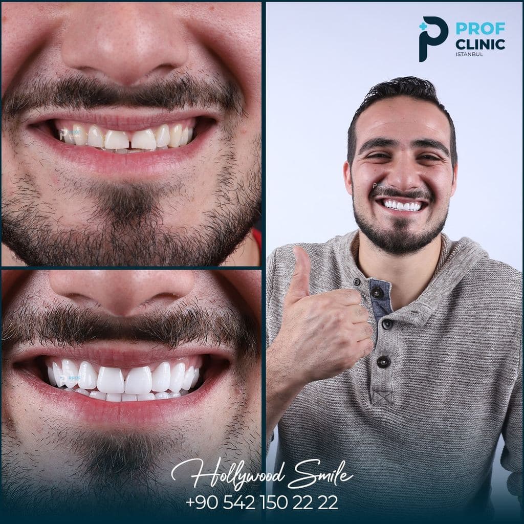 Prof Clinic | Dental Clinic Turkey — Istanbul, Turkey