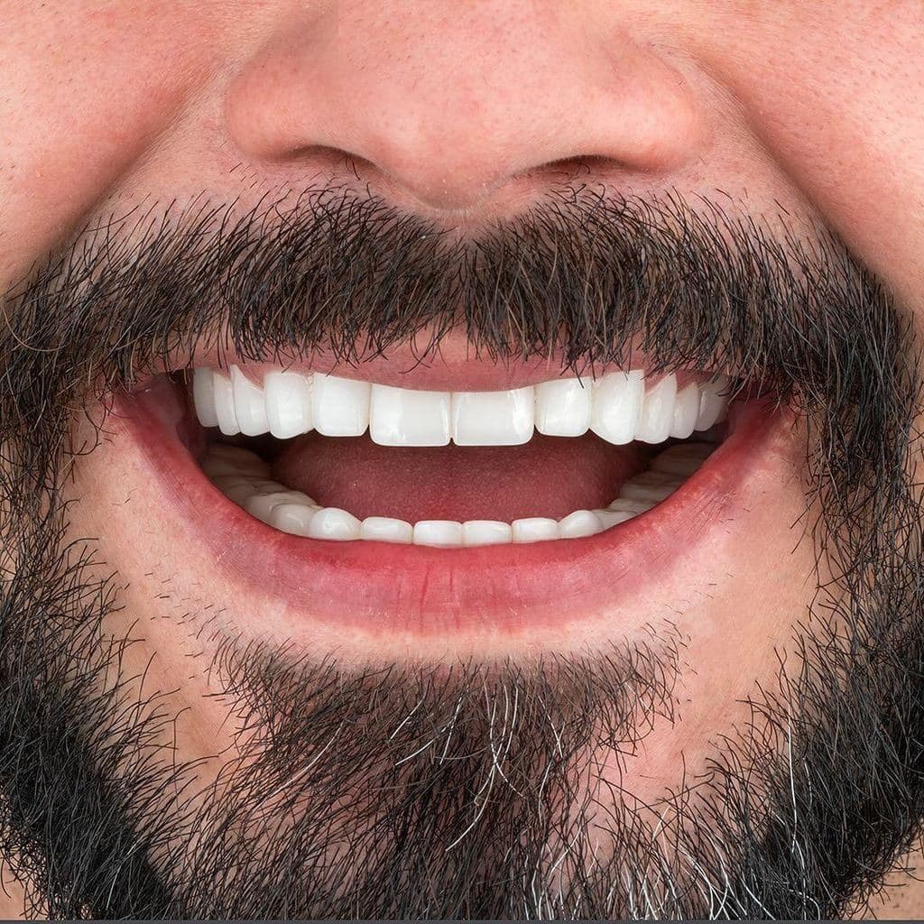 Türkiye Dental | Dental Implant | Hollywood Smile — Istanbul, Turkey