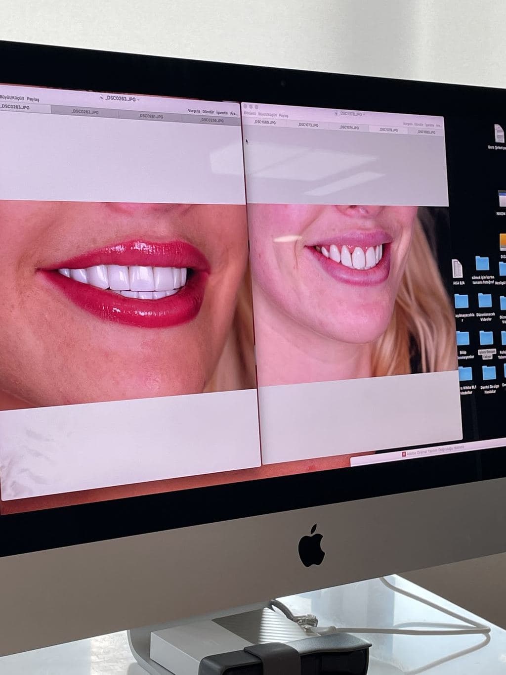 DENTAL DESIGN TURKEY (Dentist Antalya, Dental Treatments, Implants, Veneers, Smile Makeover, Cosmetic Dentistry) — Antalya, Turkey