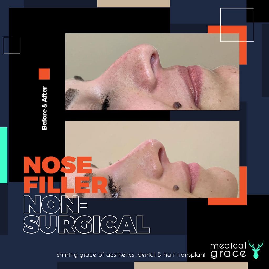 Medical Grace Bodrum Aesthetics — Bodrum, Turkey