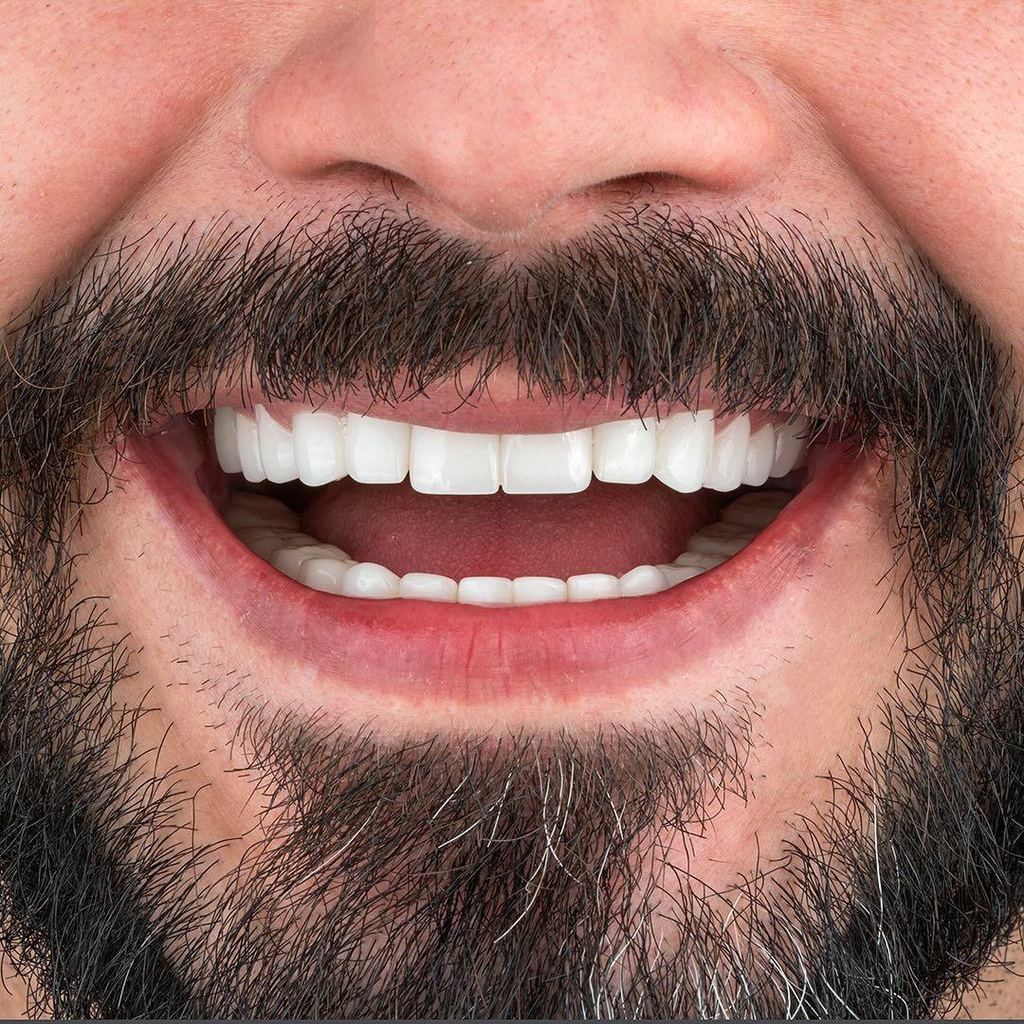Türkiye Dental | Dental Implant | Hollywood Smile — Istanbul, Turkey