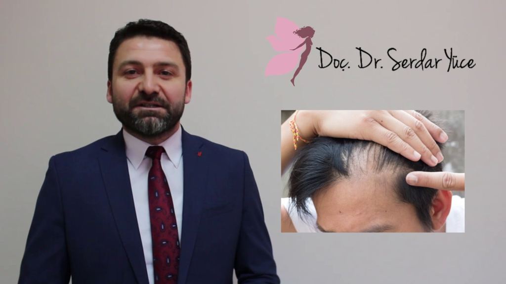 Burun Estetiği Doç.Dr.Serdar YÜCE - Ankara Fiyatları — Ankara, Turkey