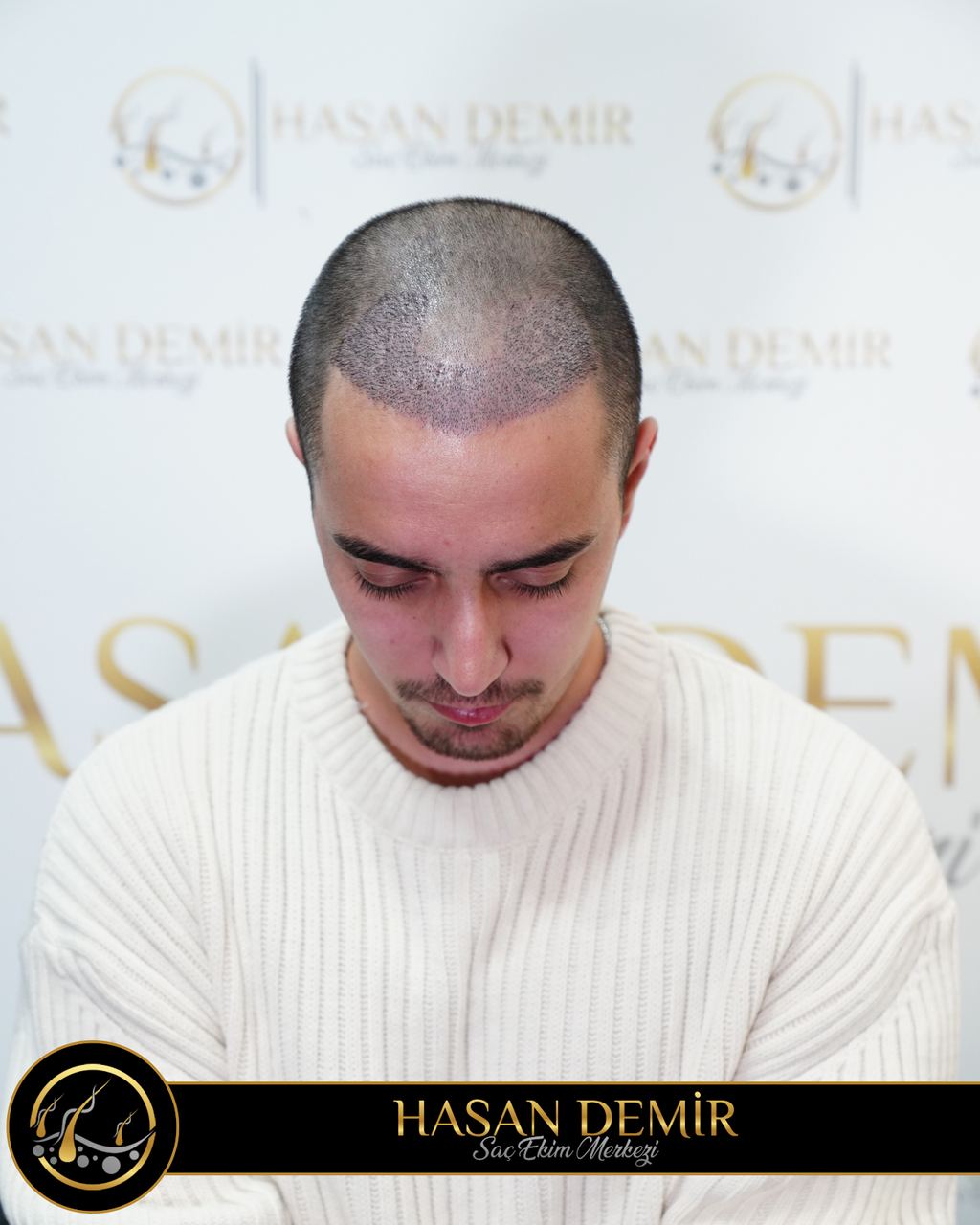 Hasan Demir Saç Ekimi Ankara — Ankara, Turkey