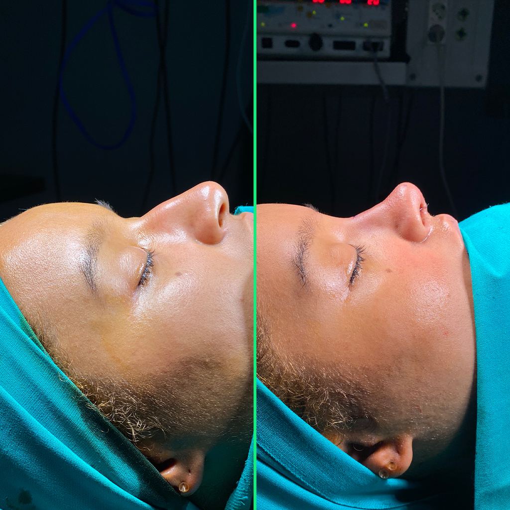 Vivid Clinic | Cosmetic Surgery Istanbul, Turkey — Istanbul, Turkey