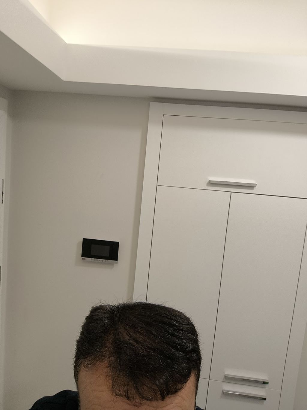 Akdeniz Antalya Saç Ekimi - Hair Transplant Antalya — Antalya, Turkey