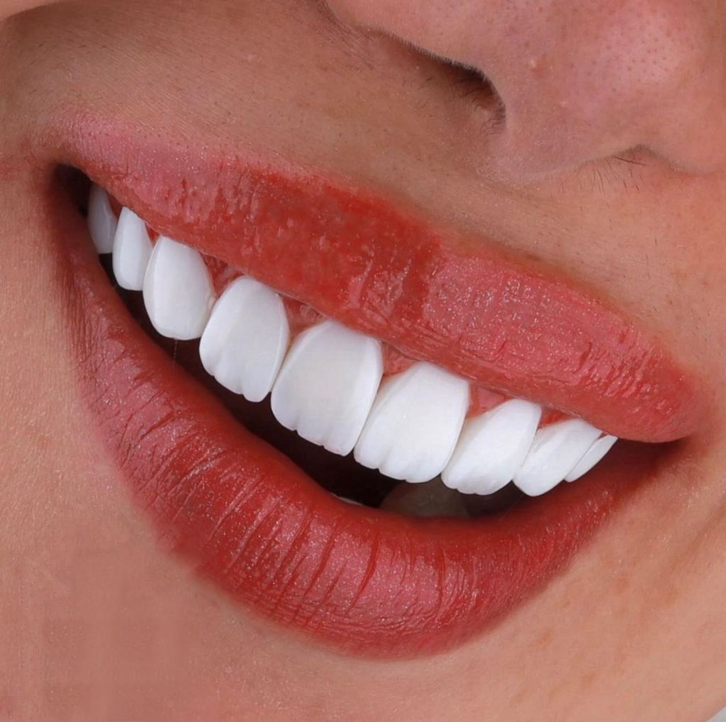 Aesthetic Bodrum | Dudak Dolgusu | Botoks | PRP | Mezoterapi | İp Askı | Cilt Bakımı | Gençlik Aşısı — Bodrum, Turkey